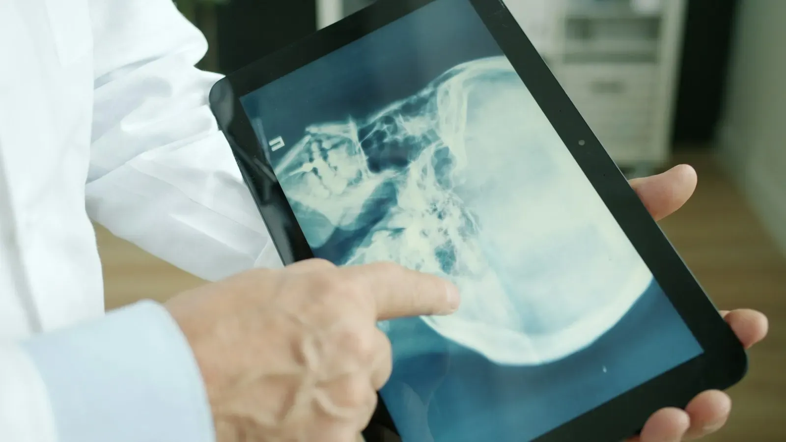 Doctor pointing at an x-ray on a tablet